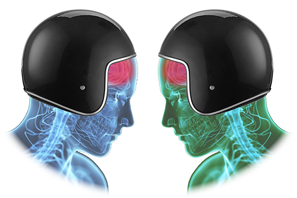 Conference: Heads up on the Concussion Issue